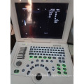 2D portable ultrasound machine and ultrasound scanner laptop